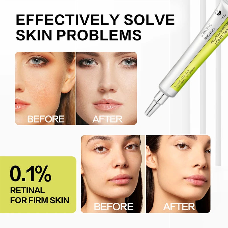 Korean Eye Cream For Anti-wrinkle & Age Retinol Eye Cream Remove Dark Circles Against Puffiness And Bags Hydrate Eye Care Cream