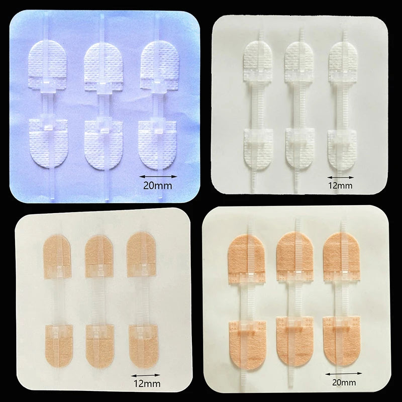 3pcs/set  Portable Zipper Tie Wound Closure Patch Hemostatic Patch Wound Fast Suture Zipper Band-Aid Outdoor  Safety Survival